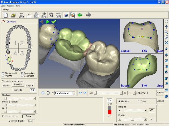 cad-cam-fogorvos cad-cam-fogorvos