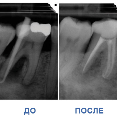 4-400x400 4-400x400