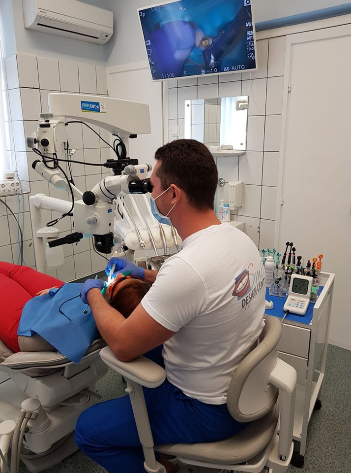 Gyökérkezelés 2. rész Smile Design Center